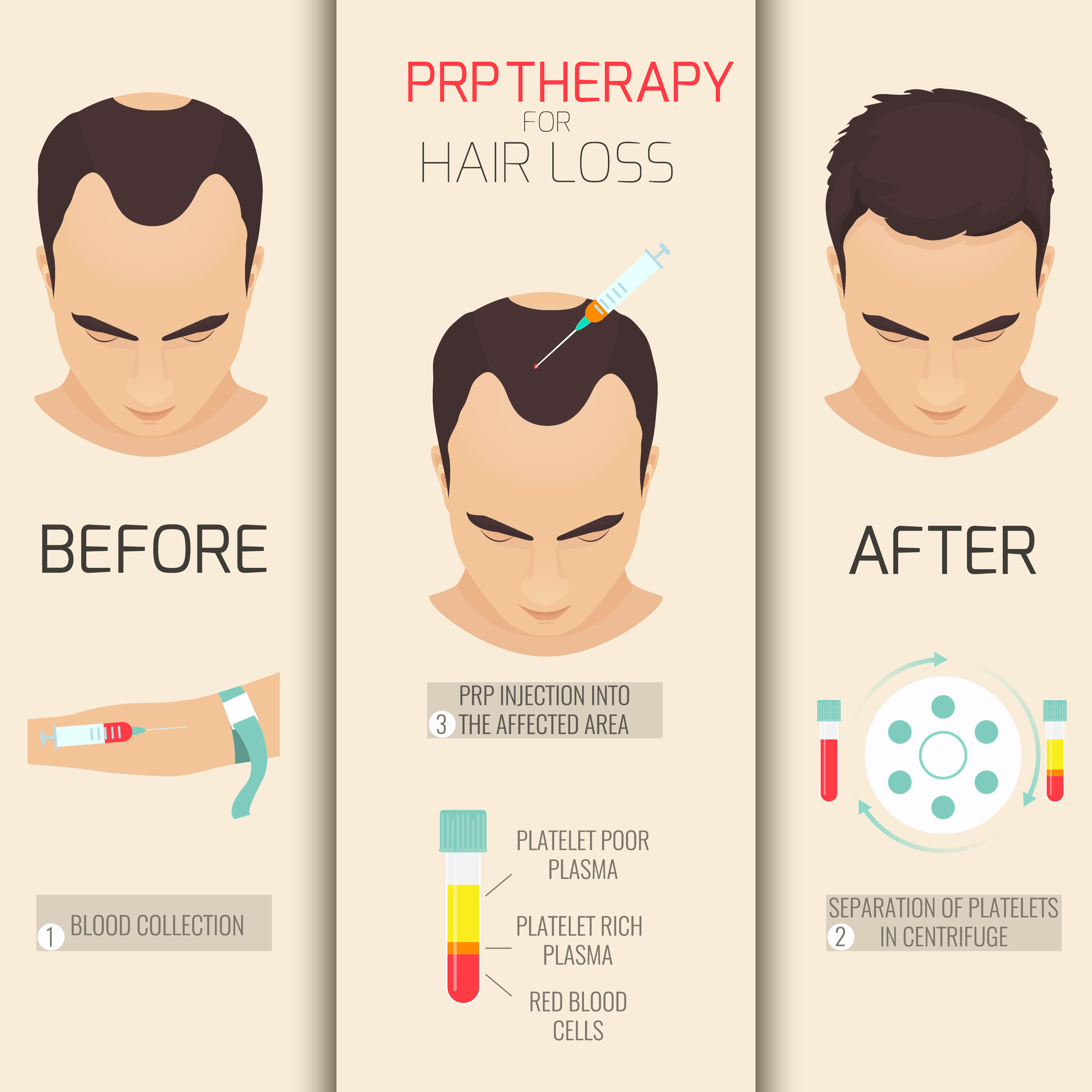 Mesotherapy